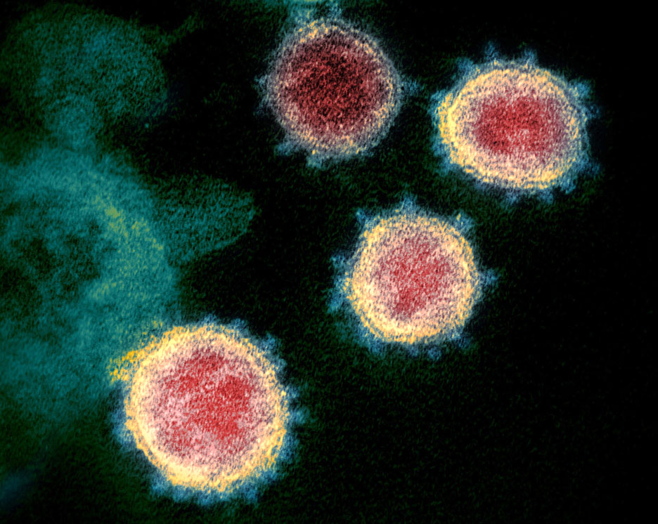 'Viral blizzard' hits Cass County as coronavirus infections reach new record - InForum | Fargo, Moorhead and West Fargo news, weather and sports - Vimarsana News